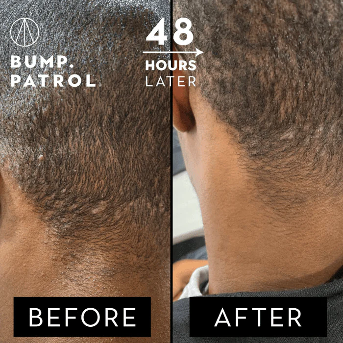 Bump Patrol - Sensitive Aftershave Treatment (Soin après rasage peau sensible) - Image 3